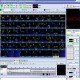 Free Shipping Quickshow China FB4 BEYOND Laser Software